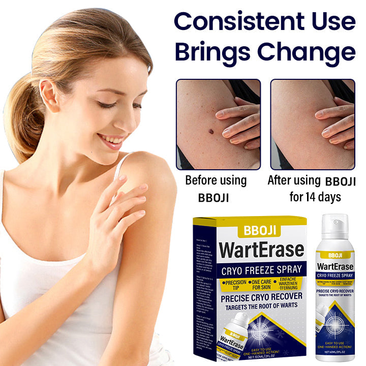 BBOJI® Wart Erase Cryo Freeze Spray