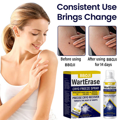 BBOJI® Wart Erase Cryo Freeze Spray