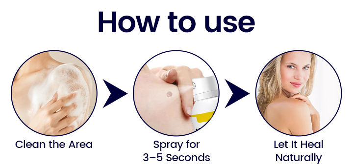 BBOJI® Wart Erase Cryo Freeze Spray