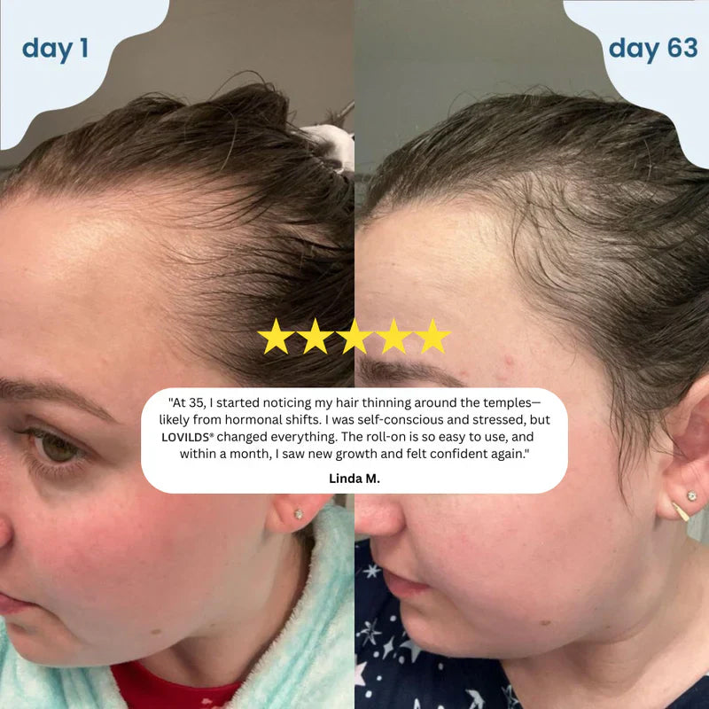 LOVILDS® Hair Growth Roll-On Serum