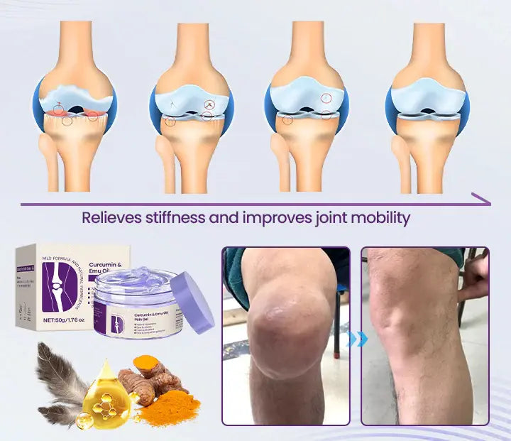 Alisanda Curcumin &Emu Oil Pain Gel