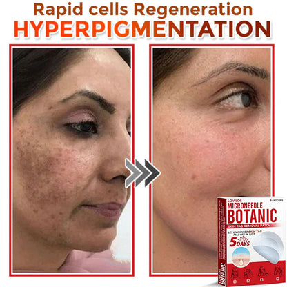 LOVILDS™-Removal Patch