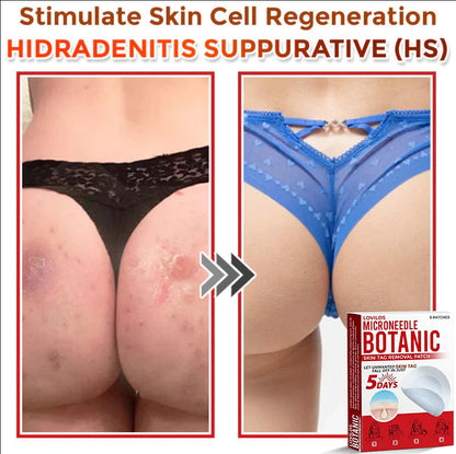 LOVILDS™-Removal Patch