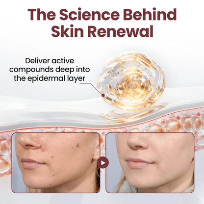 LOVILDS® KeraErase Ricedual-Action Renewal Cream