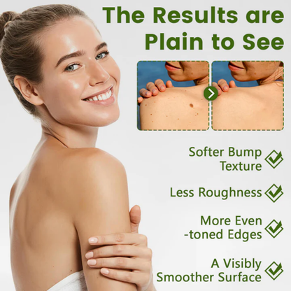 LOVILDS® ThujaClear Botanical Wart Cream