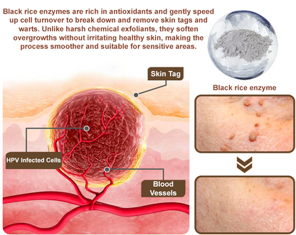 LOVILDS® Rice Bran Extract Cream | TGA-Certified Skin Growth & Keratin Care