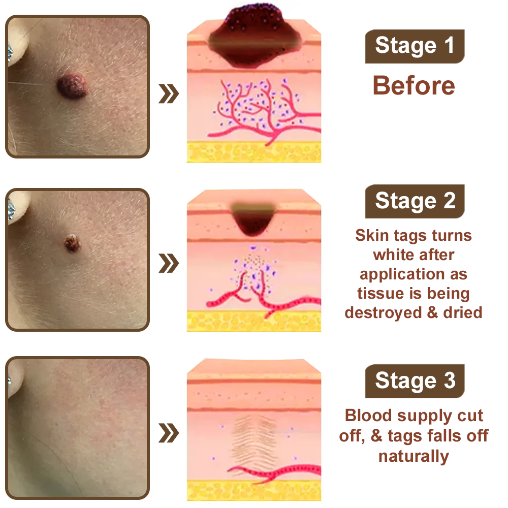 LOVILDS® Rice Bran Extract Cream | TGA-Certified Skin Growth & Keratin Care