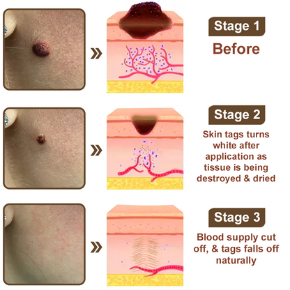 LOVILDS® Rice Bran Extract Cream | TGA-Certified Skin Growth & Keratin Care