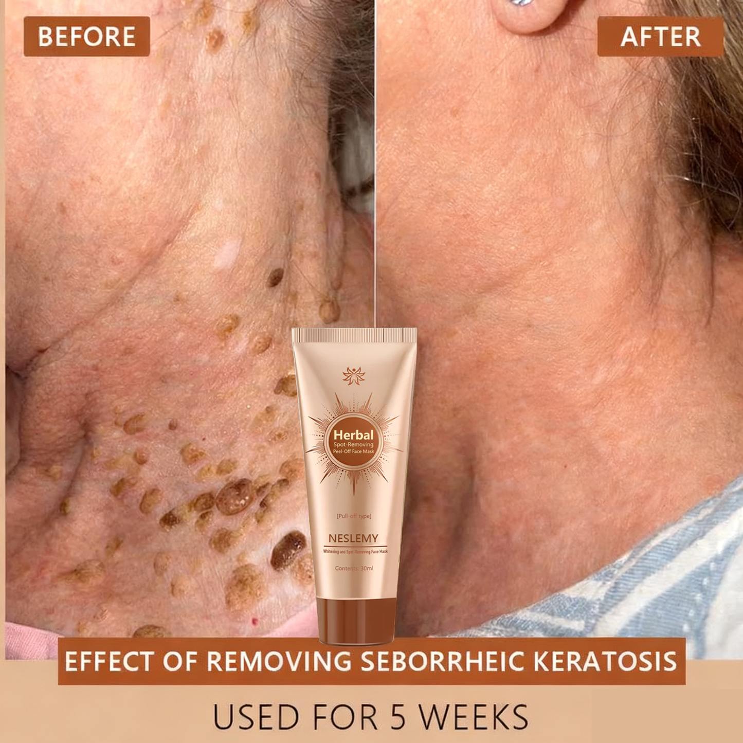 🔥🔥Black Friday Hot Selling-Whitening and Spot-Removing Face Mask Suitable for face and body – 👩‍⚕️ Natural ingredients permanently remove age spots, freckles, sun spots, and liver spots.