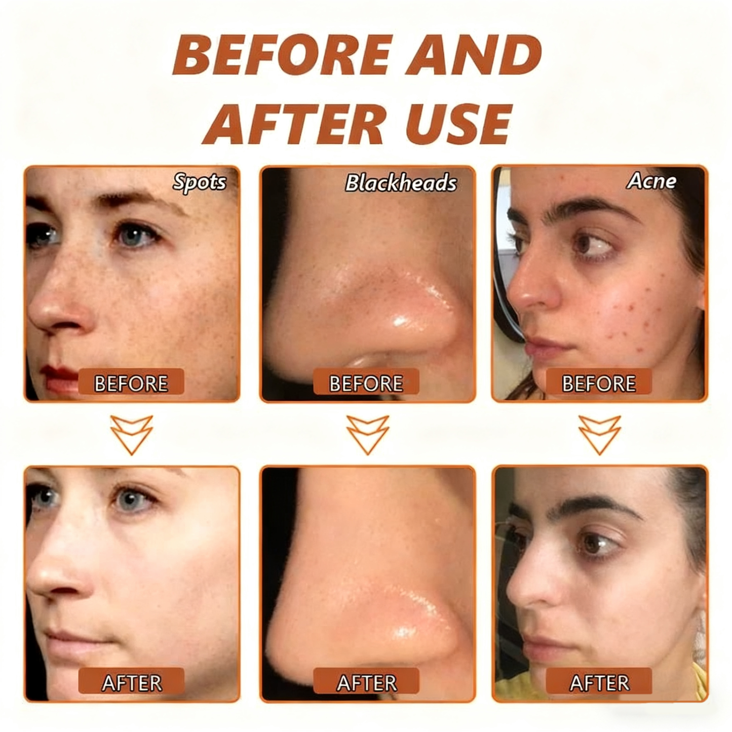 🔥🔥Black Friday Hot Selling-Whitening and Spot-Removing Face Mask Suitable for face and body – 👩‍⚕️ Natural ingredients permanently remove age spots, freckles, sun spots, and liver spots.