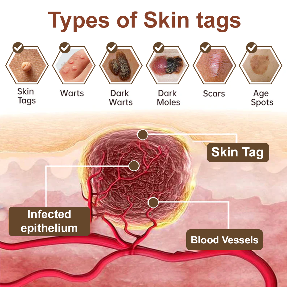 LOVILDS® Rice Bran Extract Cream | TGA-Certified Skin Growth & Keratin Care