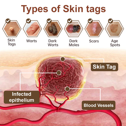 LOVILDS® Rice Bran Extract Cream | TGA-Certified Skin Growth & Keratin Care