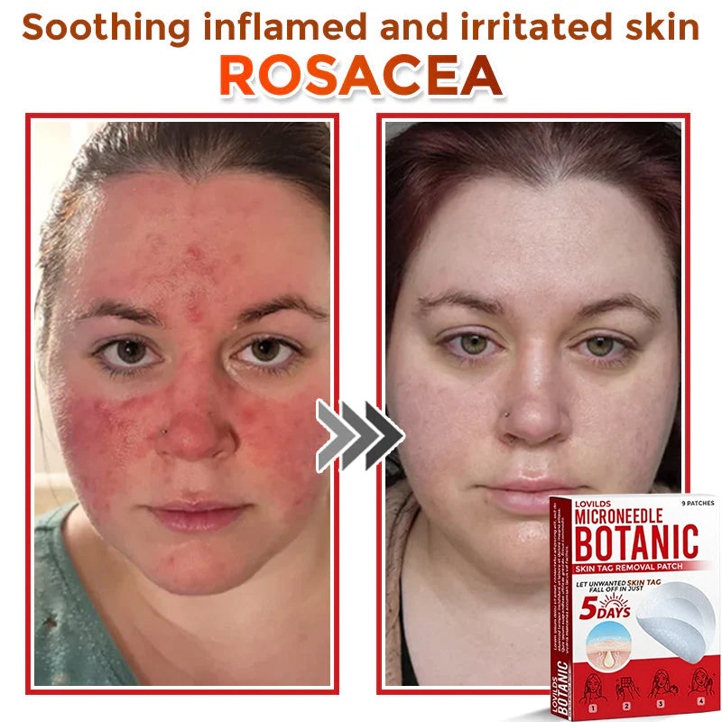 LOVILDS™-Removal Patch