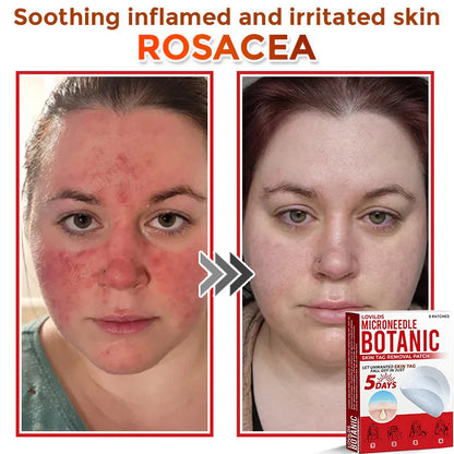 LOVILDS™-Removal Patch