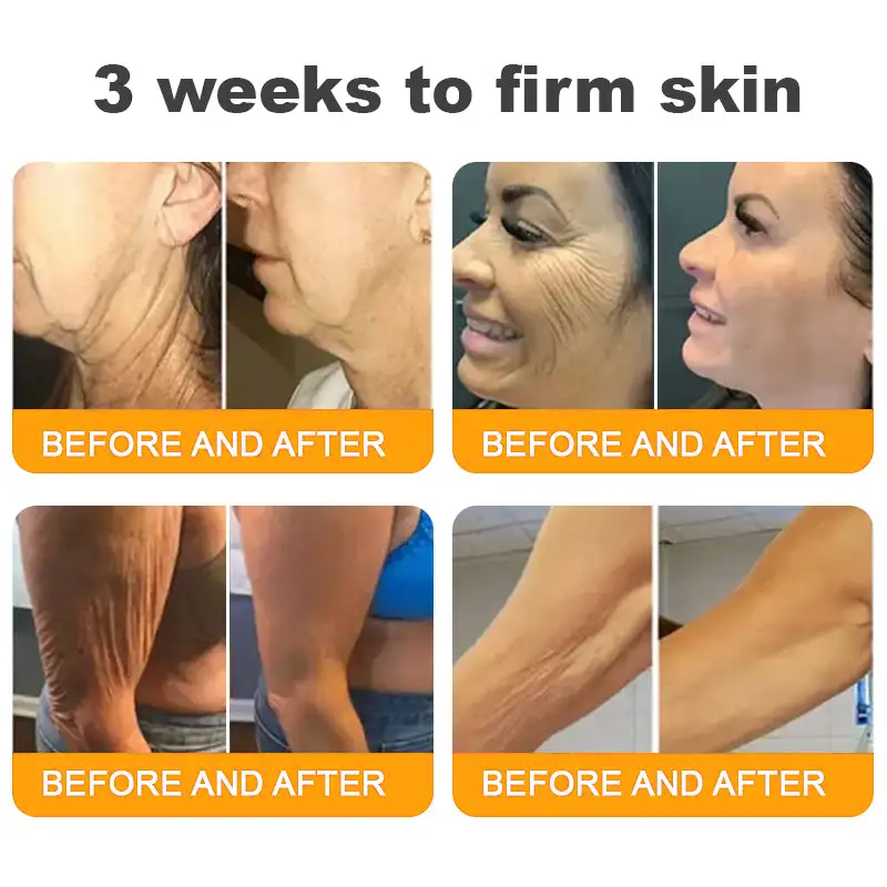 ✨FDA Approved:LOVILDS™  Bee Venom Skin Restoration Cream — 🔥Limited Time 70% OFF🔥