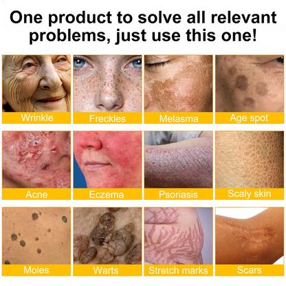 ✨FDA Approved:LOVILDS™  Bee Venom Skin Restoration Cream — 🔥Limited Time 70% OFF🔥