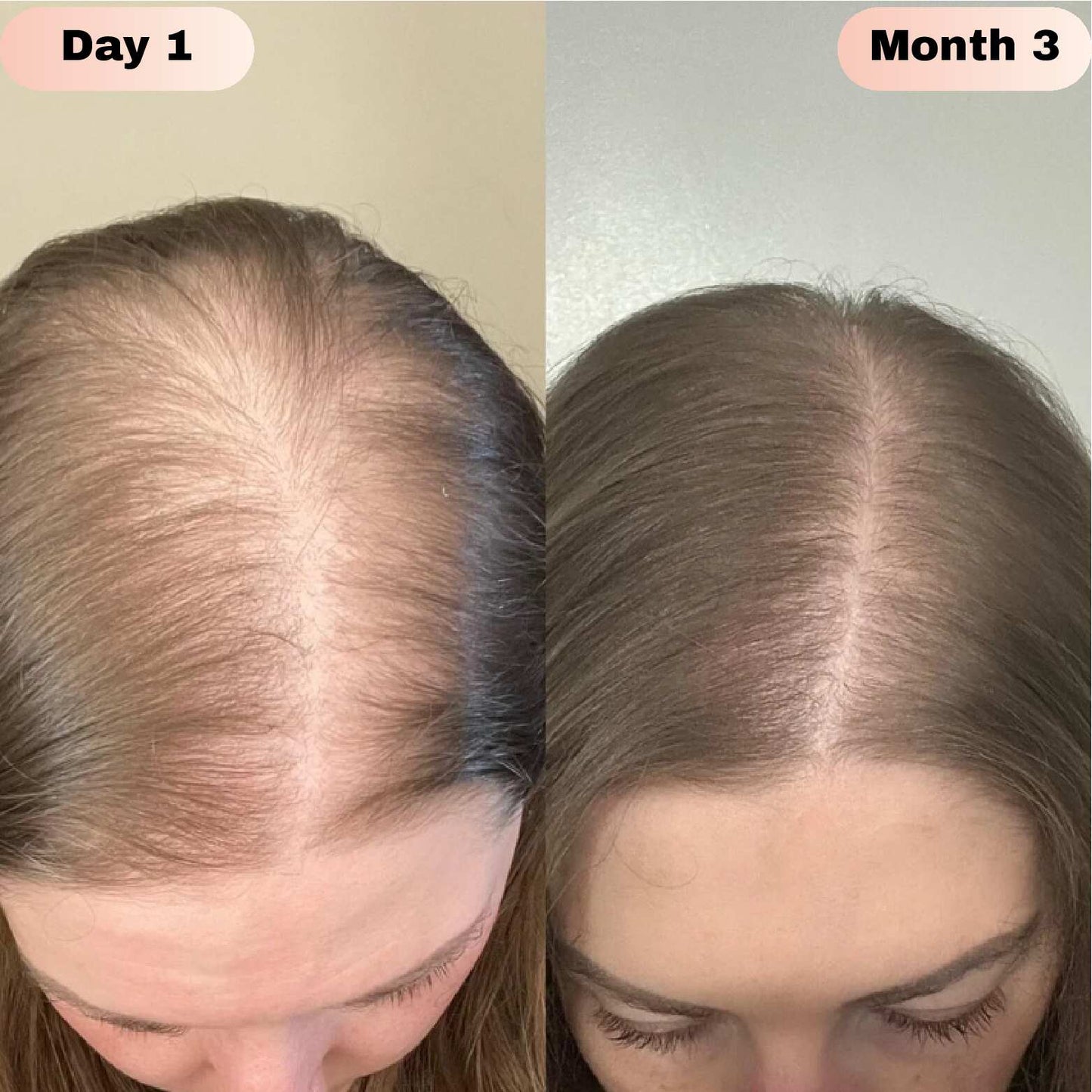 LOVILDS® Hair Growth Roll-On Serum