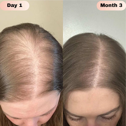 LOVILDS® Hair Growth Roll-On Serum