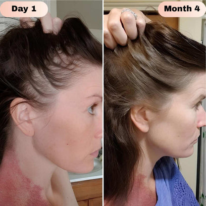 LOVILDS® Hair Growth Roll-On Serum