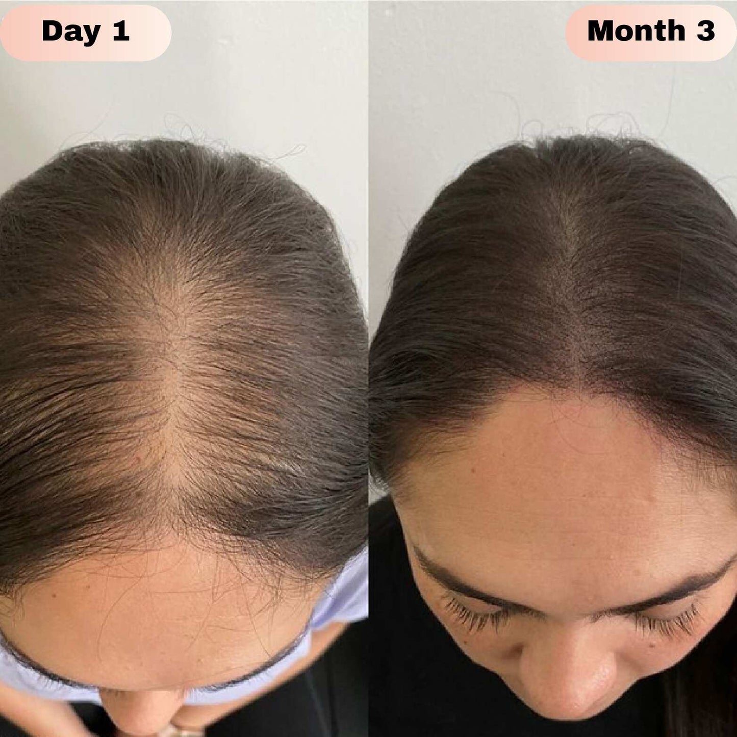 LOVILDS® Hair Growth Roll-On Serum