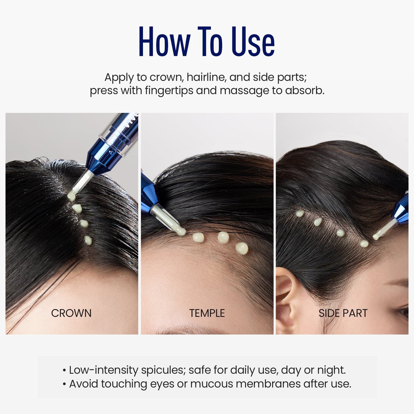 LOVILDS® Scalp Serum 400 – 220K Micro-Spicules for Thicker, Fuller Hair | Korea’s Best-Selling Dermatologist-Recommended K-Beauty Scalp Serum (0.5 fl oz)