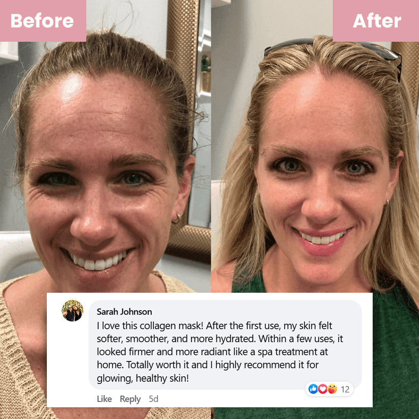 🔥🔥Black Friday Hot Sale-LOVILDS® Collagen Night Wrapping Mask