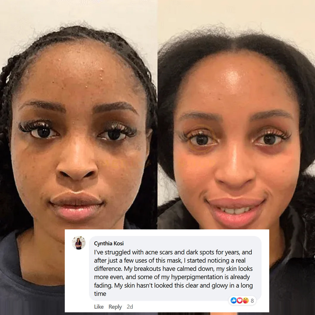 🔥🔥Black Friday Hot Sale-LOVILDS® Collagen Night Wrapping Mask